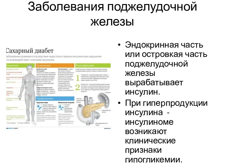 Заболевания поджелудочной железы Эндокринная часть или островкая часть поджелудочной железы