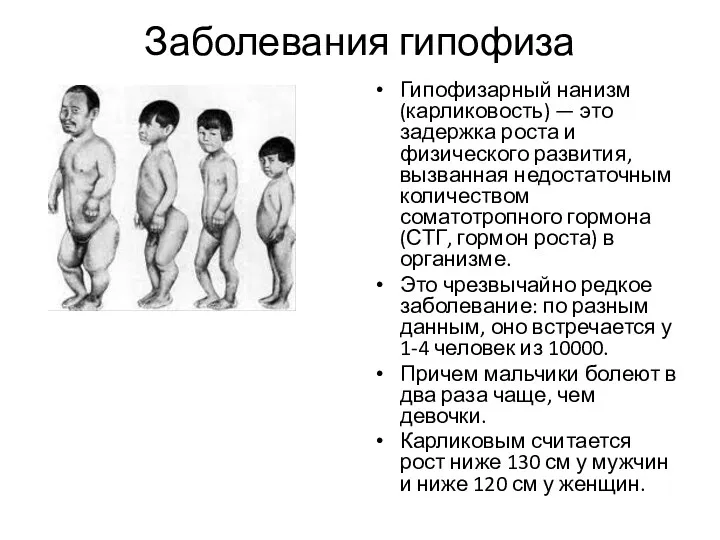 Заболевания гипофиза Гипофизарный нанизм (карликовость) — это задержка роста и