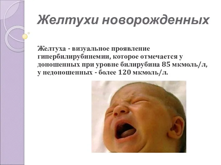 Желтухи новорожденных Желтуха - визуальное проявление гипербилирубинемии, которое отмечается у