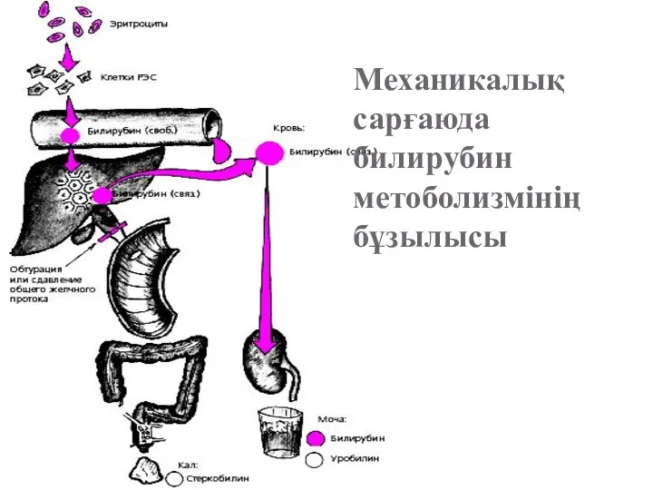 Механикалық сарғаюда билирубин метоболизмінің бұзылысы