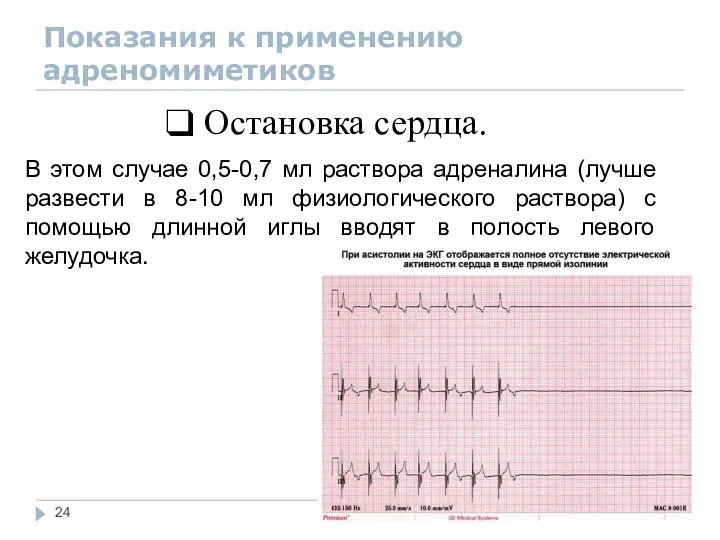 Показания к применению адреномиметиков Остановка сердца. В этом случае 0,5-0,7