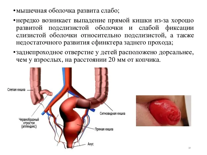 мышечная оболочка развита слабо; нередко возникает выпадение прямой кишки из-за