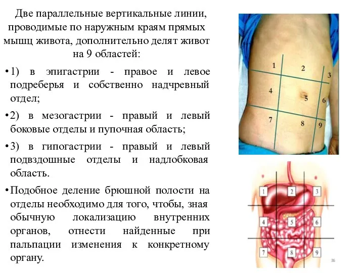 Две параллельные вертикальные линии, проводимые по наружным краям прямых мышц