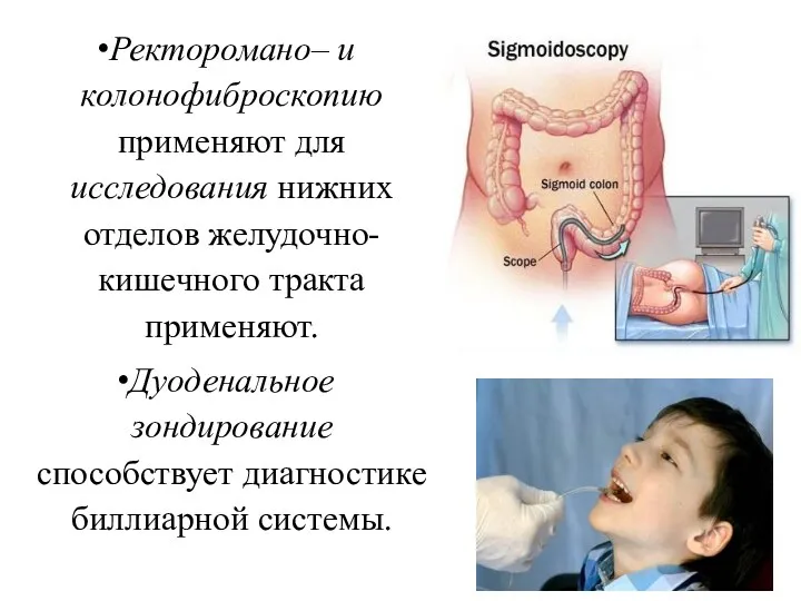 Ректоромано– и колонофиброскопию применяют для исследования нижних отделов желудочно-кишечного тракта