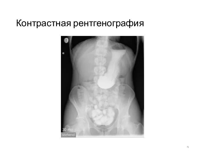 Контрастная рентгенография