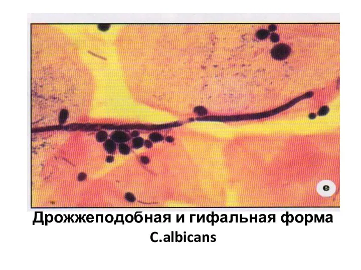 Дрожжеподобная и гифальная форма C.albicans