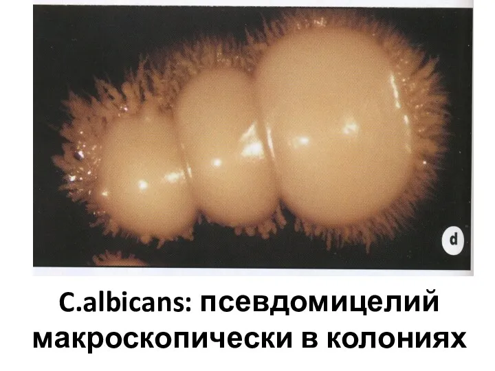 C.albicans: псевдомицелий макроскопически в колониях