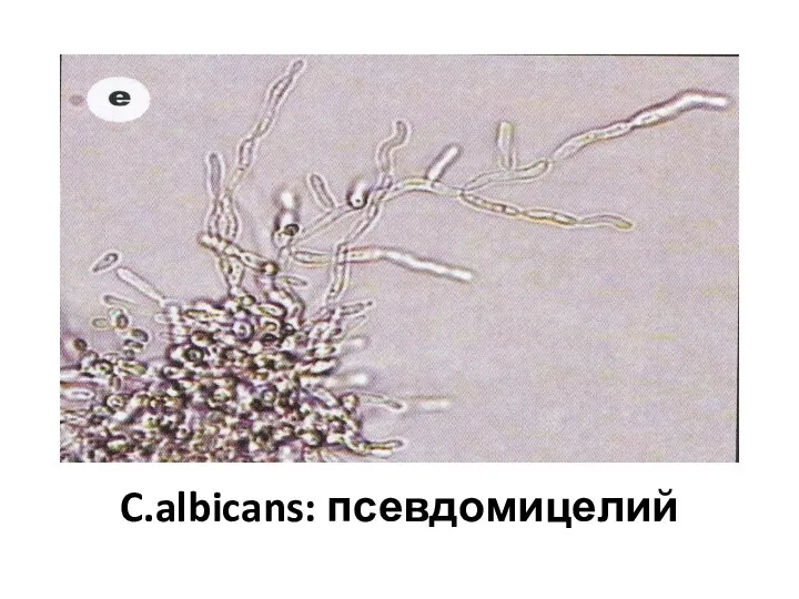 C.albicans: псевдомицелий