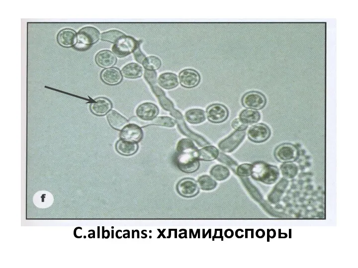 C.albicans: хламидоспоры