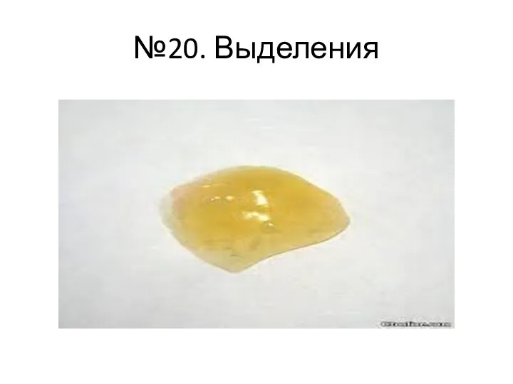 №20. Выделения