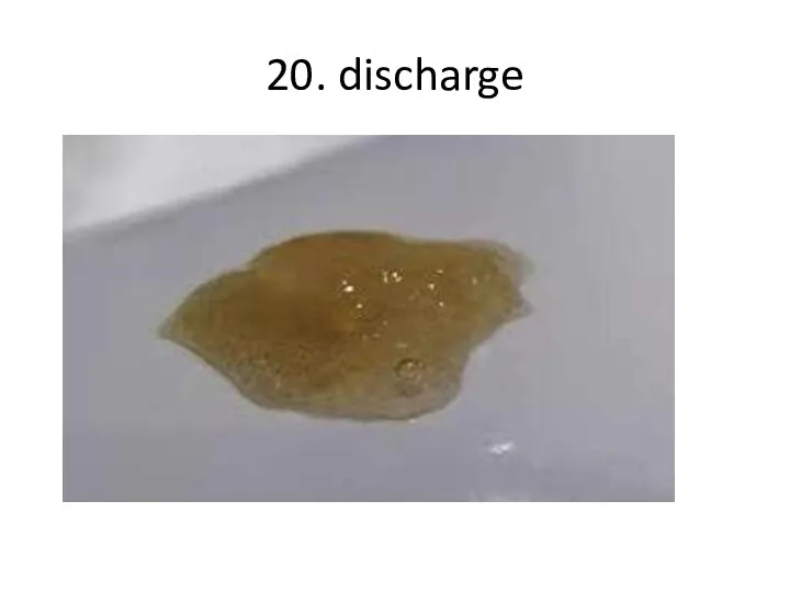 20. discharge