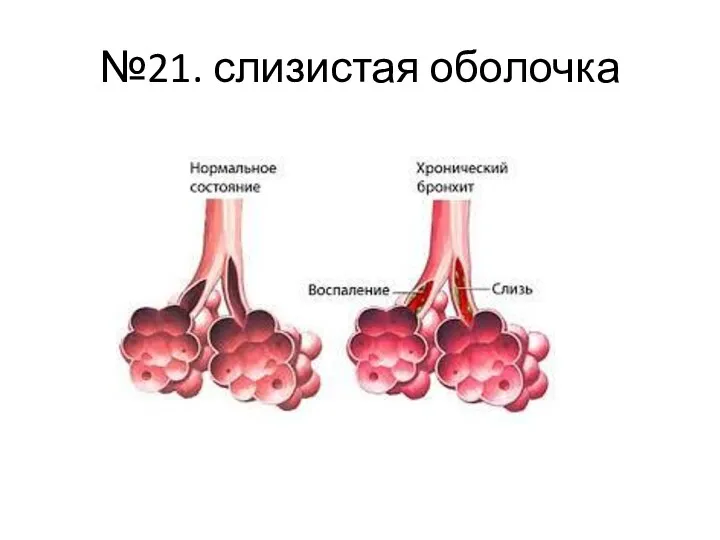 №21. слизистая оболочка