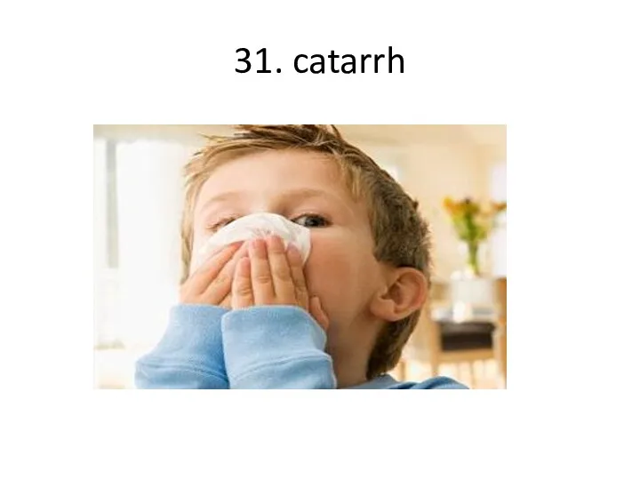 31. catarrh