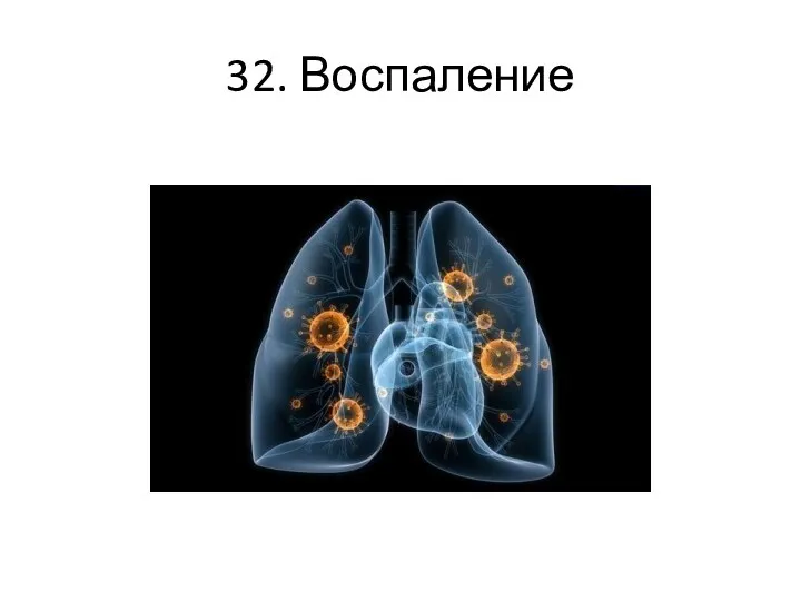 32. Воспаление