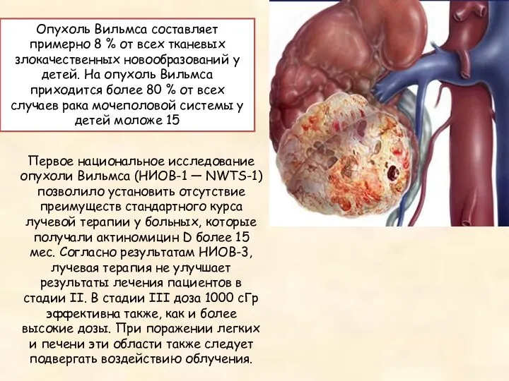 Первое национальное исследование опухоли Вильмса (НИОВ-1 — NWTS-1) позволило установить