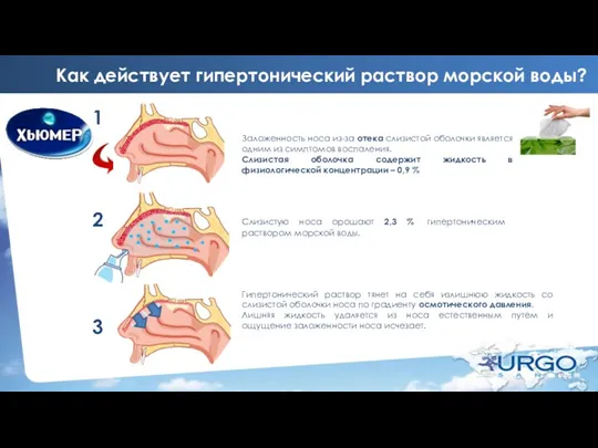 Как действует гипертонический раствор морской воды? Заложенность носа из-за отека