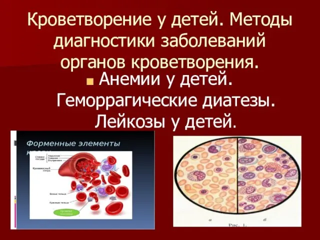 Кроветворение у детей. Методы диагностики заболеваний органов кроветворения