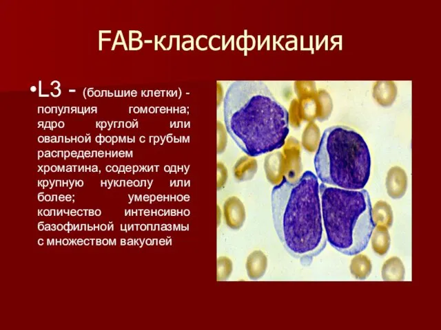 FAB-классификация L3 - (большие клетки) - популяция гомогенна; ядро круглой