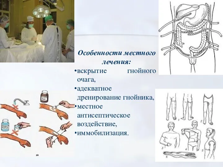 Особенности местного лечения: вскрытие гнойного очага, адекватное дренирование гнойника, местное антисептическое воздействие, иммобилизация.