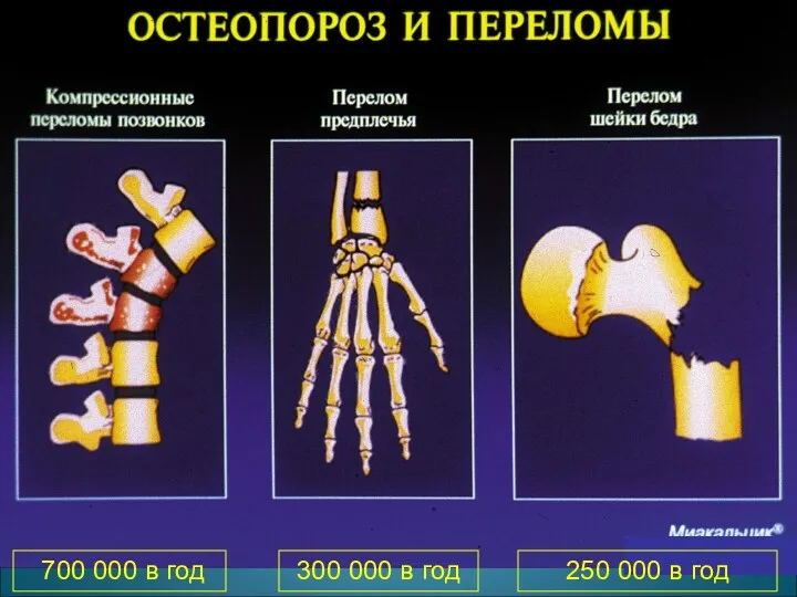 700 000 в год 300 000 в год 250 000 в год