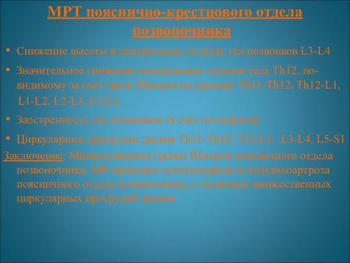 МРТ пояснично-крестцового отдела позвоночника Снижение высоты в центральных отделах тел