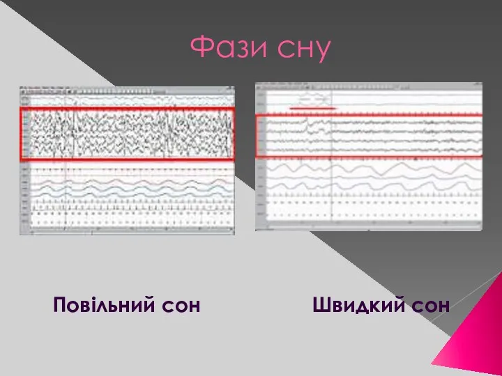 Фази сну Повільний сон Швидкий сон