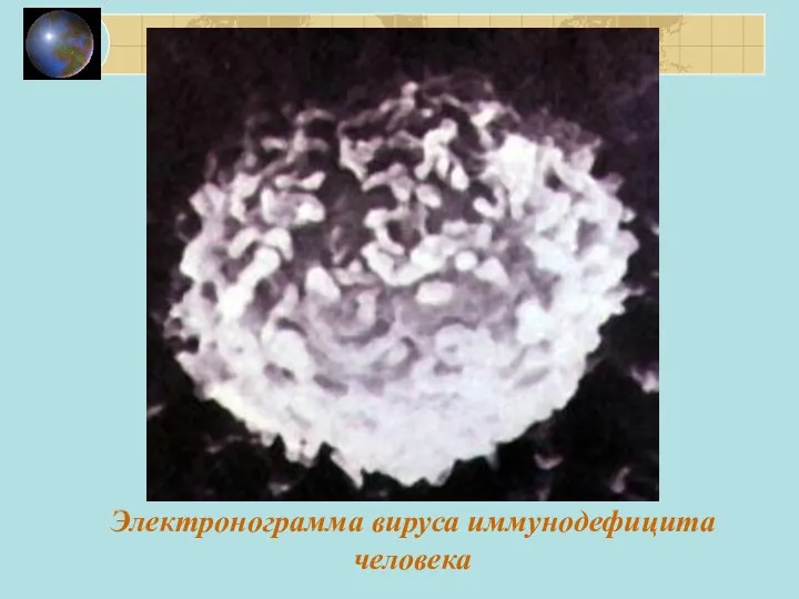Электронограмма вируса иммунодефицита человека