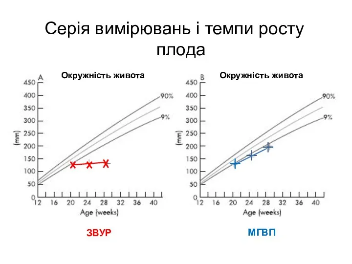 Серія вимірювань і темпи росту плода ЗВУР МГВП Окружність живота Окружність живота