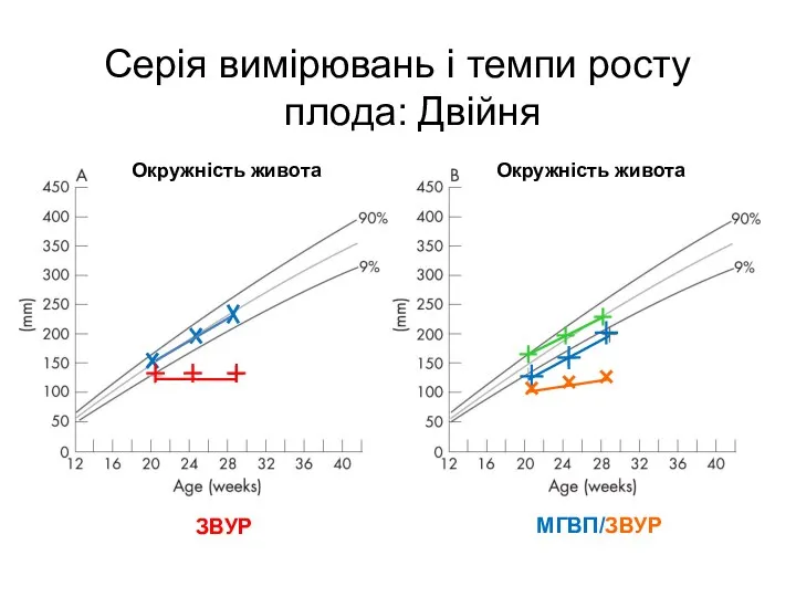 Серія вимірювань і темпи росту плода: Двійня ЗВУР МГВП/ЗВУР Окружність живота Окружність живота