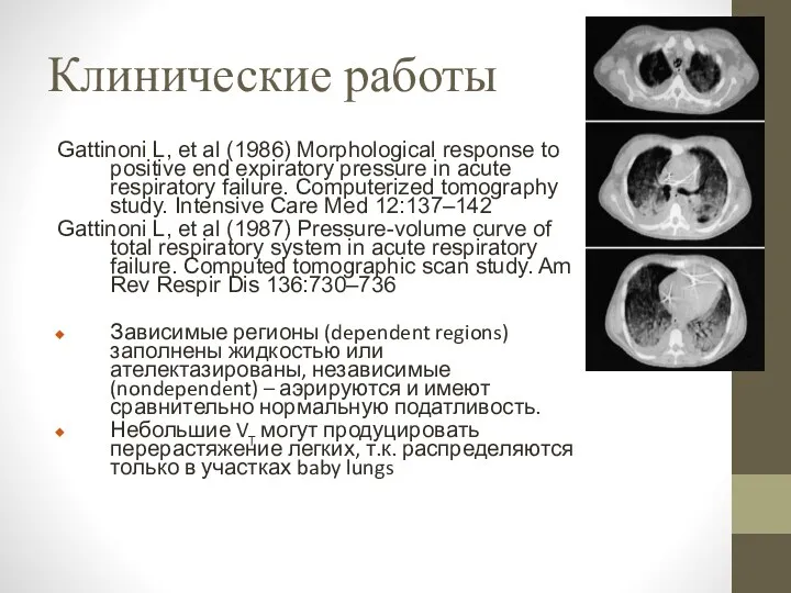 Клинические работы Gattinoni L, et al (1986) Morphological response to positive end expiratory