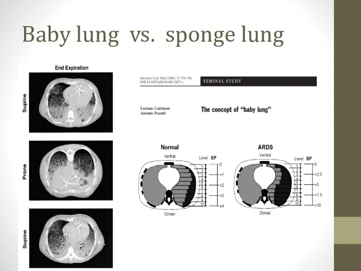 Baby lung vs. sponge lung
