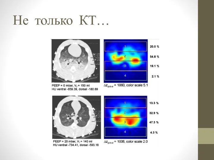 Не только КТ…