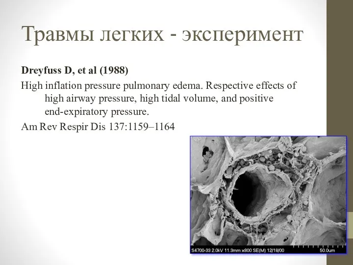 Травмы легких - эксперимент Dreyfuss D, et al (1988) High inflation pressure pulmonary