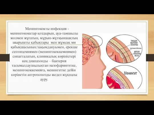 Менингококты инфекция - менингококктар қоздырып, ауа-тамшылы жолмен жұғатын, мұрын-жұтқыншақтың шырышты