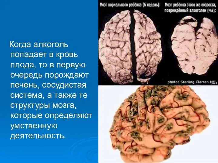 Когда алкоголь попадает в кровь плода, то в первую очередь