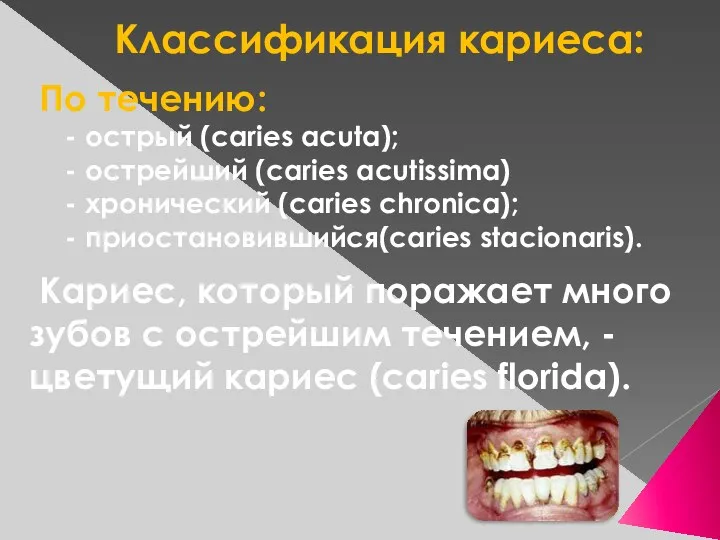 Классификация кариеса: По течению: - острый (caries acuta); - острейший