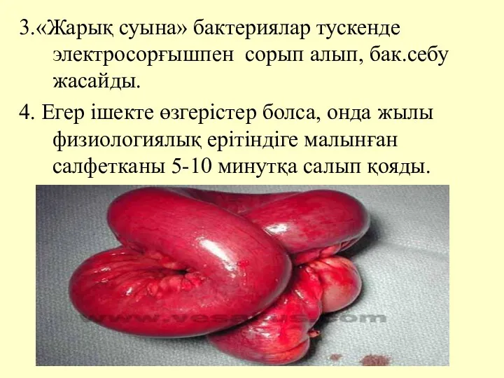 3.«Жарық суына» бактериялар тускенде электросорғышпен сорып алып, бак.себу жасайды. 4.