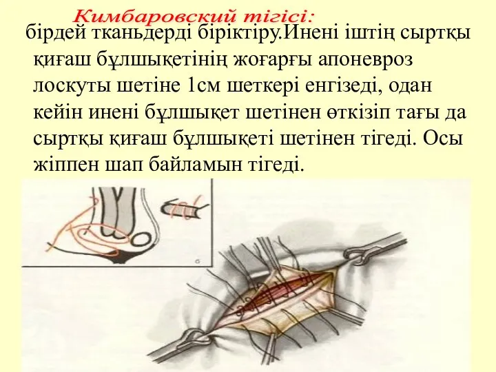 бірдей тканьдерді біріктіру.Инені іштің сыртқы қиғаш бұлшықетінің жоғарғы апоневроз лоскуты