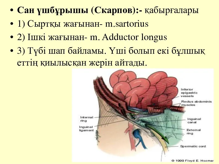 Сан үшбұрышы (Скарпов):- қабырғалары 1) Сыртқы жағынан- m.sartorius 2) Ішкі