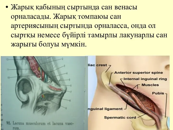 Жарық қабының сыртында сан венасы орналасады. Жарық томпаюы сан артериясының