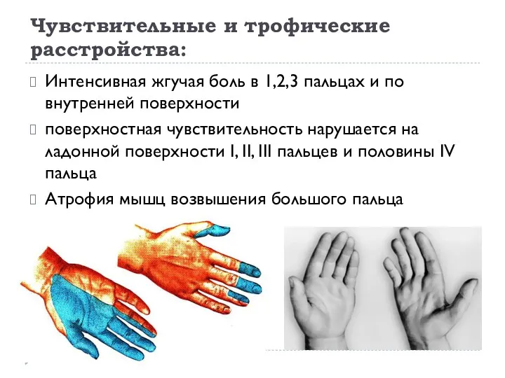 Чувствительные и трофические расстройства: Интенсивная жгучая боль в 1,2,3 пальцах