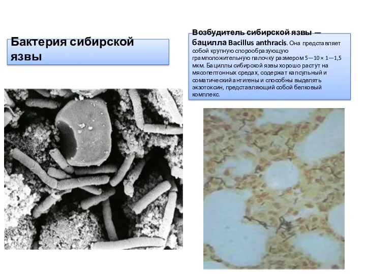 Бактерия сибирской язвы Возбудитель сибирской язвы — бацилла Bacillus anthracis. Она представляет собой
