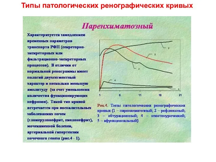 Типы патологических ренографических кривых