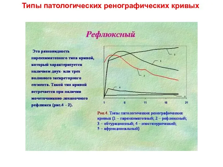 Типы патологических ренографических кривых