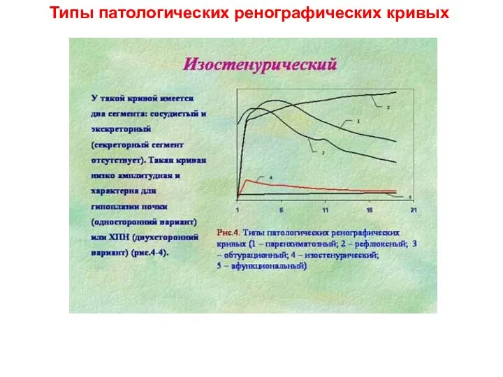 Типы патологических ренографических кривых