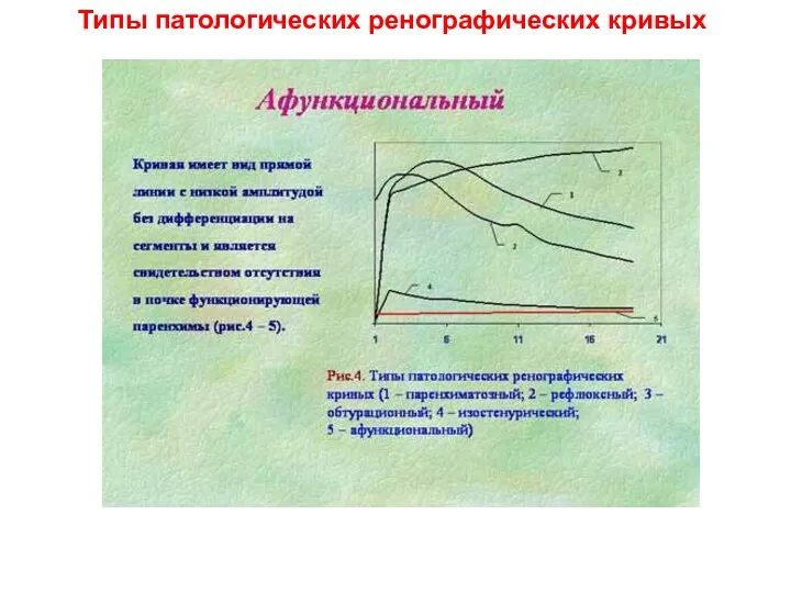 Типы патологических ренографических кривых