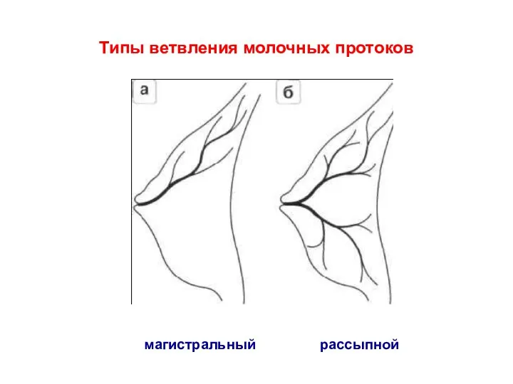 Типы ветвления молочных протоков магистральный рассыпной