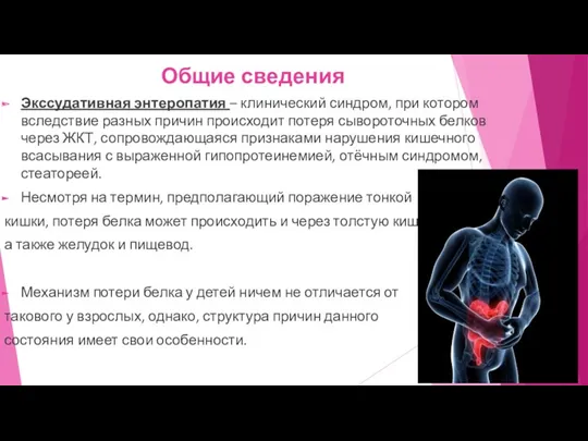 Общие сведения Экссудативная энтеропатия – клинический синдром, при котором вследствие разных причин происходит