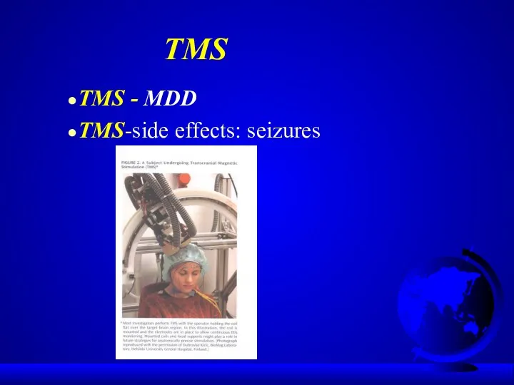 TMS TMS - MDD TMS-side effects: seizures