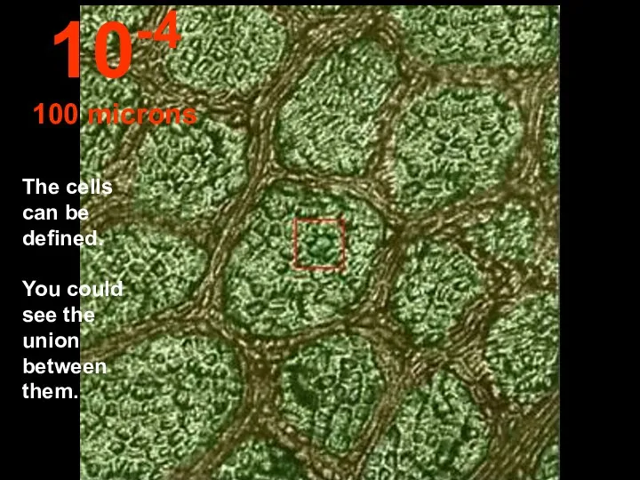 The cells can be defined. You could see the union between them. 10-4 100 microns